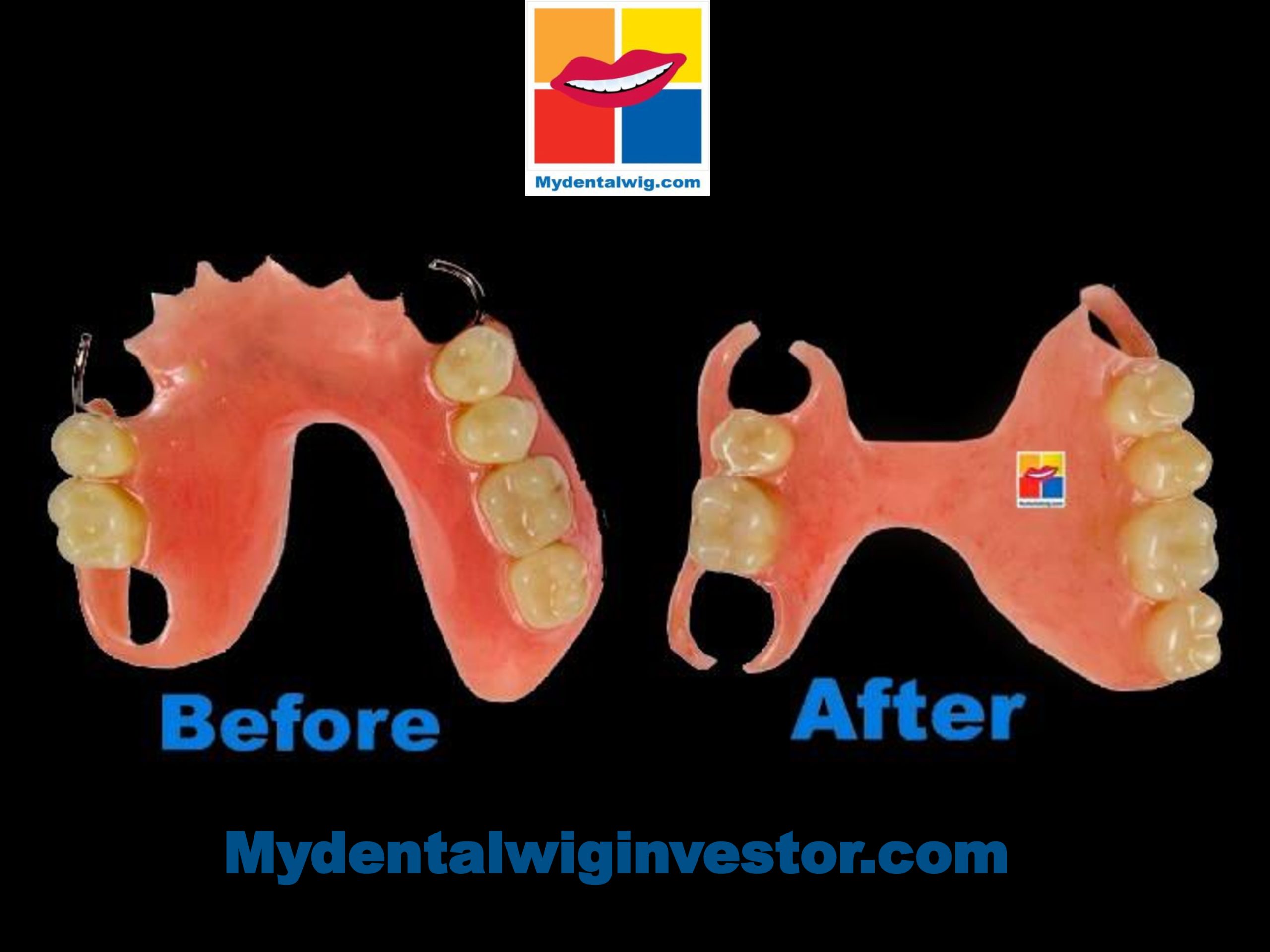 Why Inno, The Ambitious Certified Nursing Assistant From USA Invested In MYDENTALWIG?
